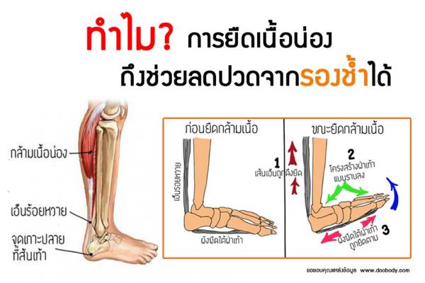 ทำไม ? การยืดเนื้อน่องถึงช่วยลดปวดจากรองช้ำได้